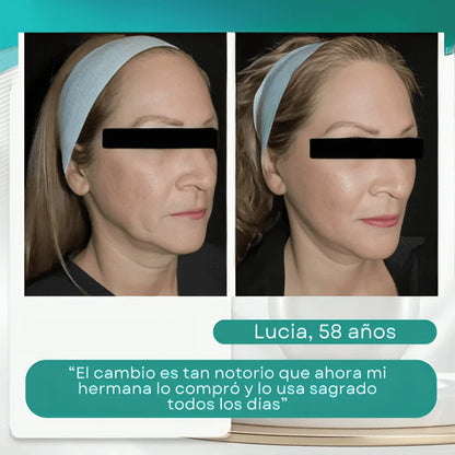 LiftGlow™: Tu Piel Visiblemente más Joven y Firme desde el Primer Uso ✅