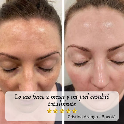Óleo Rosa Mosqueta 30ml - El oro líquido coreano suaviza arrugas y deja piel de porcelana ✨ 45% OFF