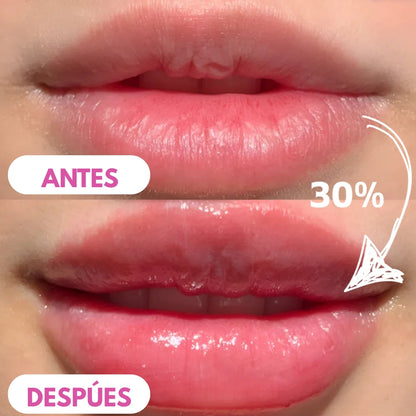 Kit Voluminizador de Labios - Más carnosos e hidratados sin dolor o picazón 💋 HOY 50% OFF!