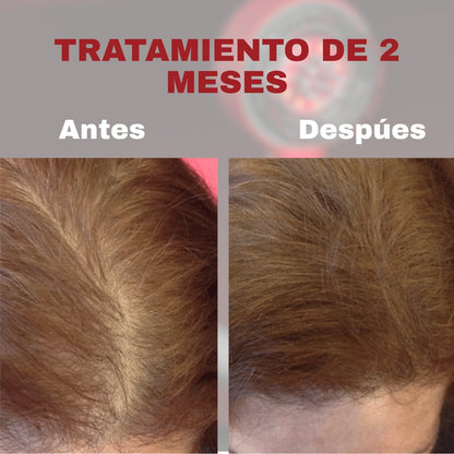 Capilux Pro™ Cepillo Infrarojo - Detiene la caída, engrosa y crece el cabello 2 veces más rápido ✨ HOY 45% OFF